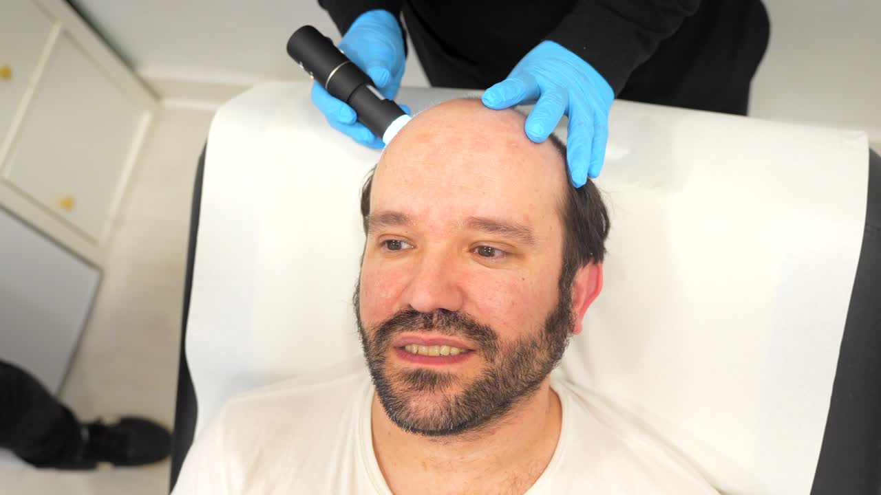 tratamiento de la pérdida de cabello