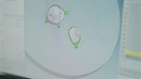 dental cad/cam software designing zirconia crowns