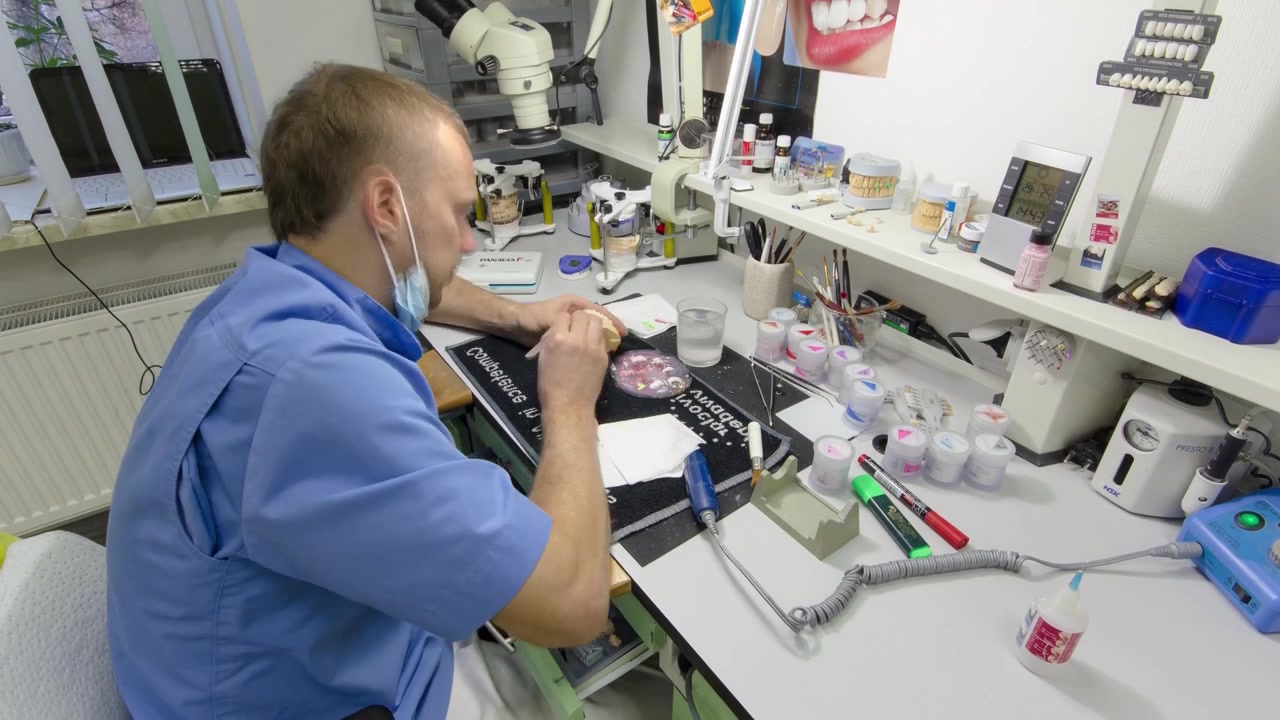 Un tecnico dentale lavora con una protesi dentale completa in metallo-ceramica inferiore e superiore, timelapse in fase finale. Il dentista lavora con un pennello su un modello di mascella in un laboratorio clinico