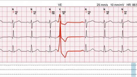 close up of an electrocardiogram in digital form