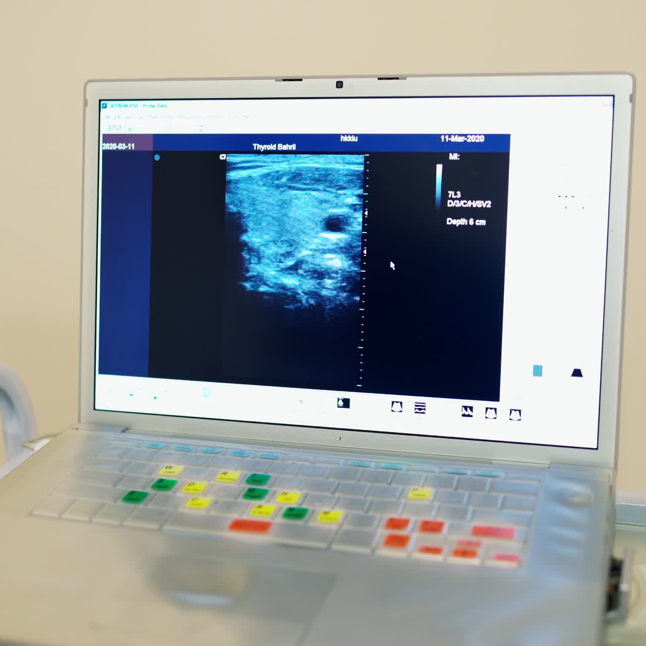 Modern ultrasound monitor