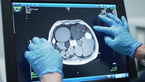 medical professionals analyze detailed cross-section imaging, focusing on tissue structures and anomalies in a computer-generated tomographic scan for diagnostic purposes