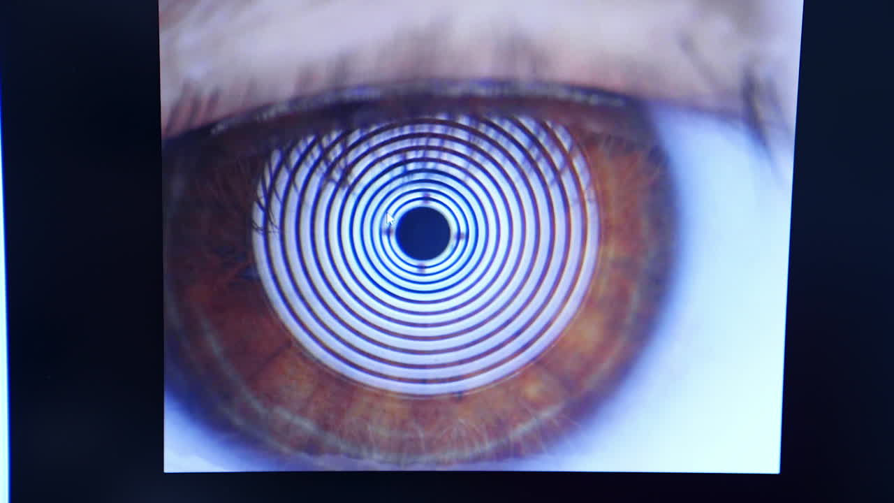 Patient's eye on screen. Computer screen showing eyeball problems. Optometrist checks vision using autorefractor. Close-up.