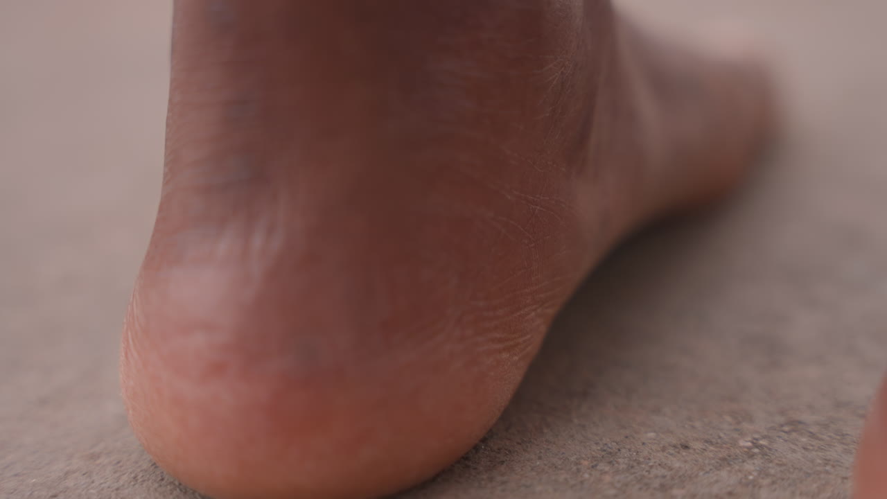 Esame della pelle del piede. Vista clinica della condizione del piede. Valutazione medica del tallone per la guarigione e la salute della pelle. Esame clinico dettagliato incentrato sulla pelle secca e sul processo di trattamento dei calli.