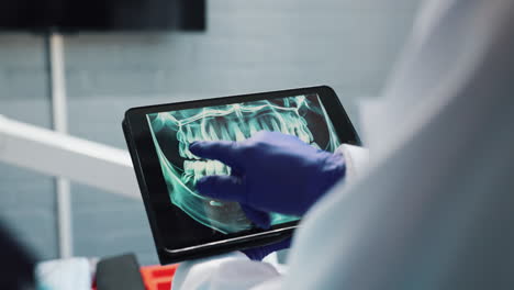 dental x-ray on tablet