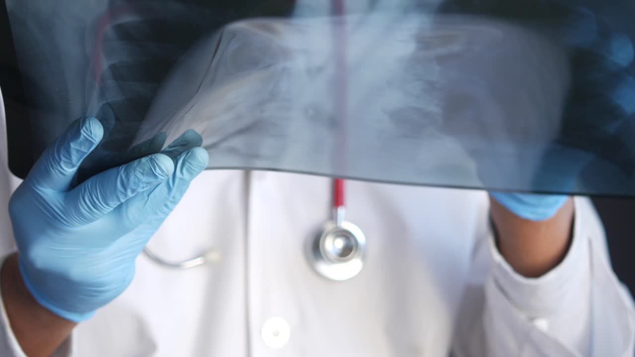 부 스레이를 검사하는 의사