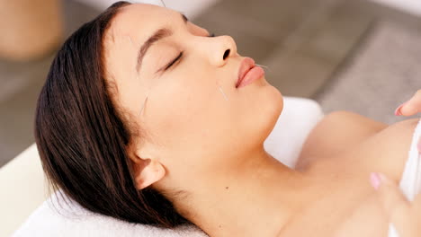 Acupuncture,-face-and-therapy-with-woman-at-spa