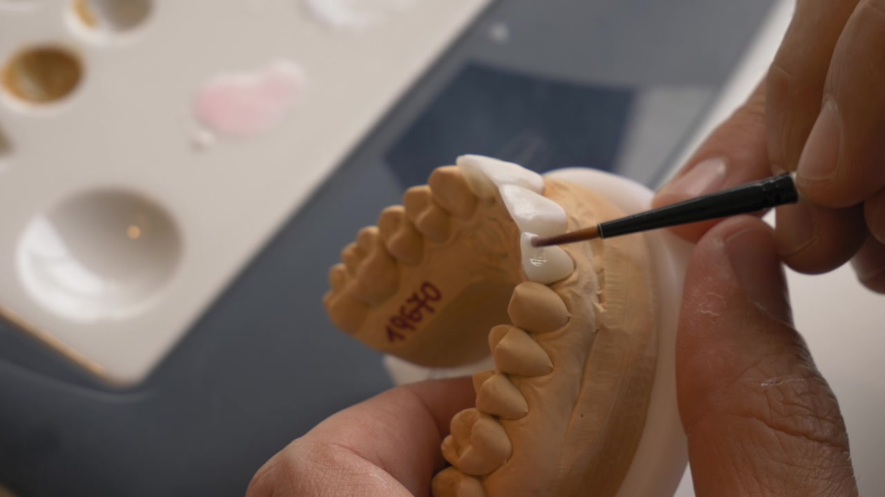 Close-up de protético aplicando revestimento a um modelo dentário com um pincel fino
