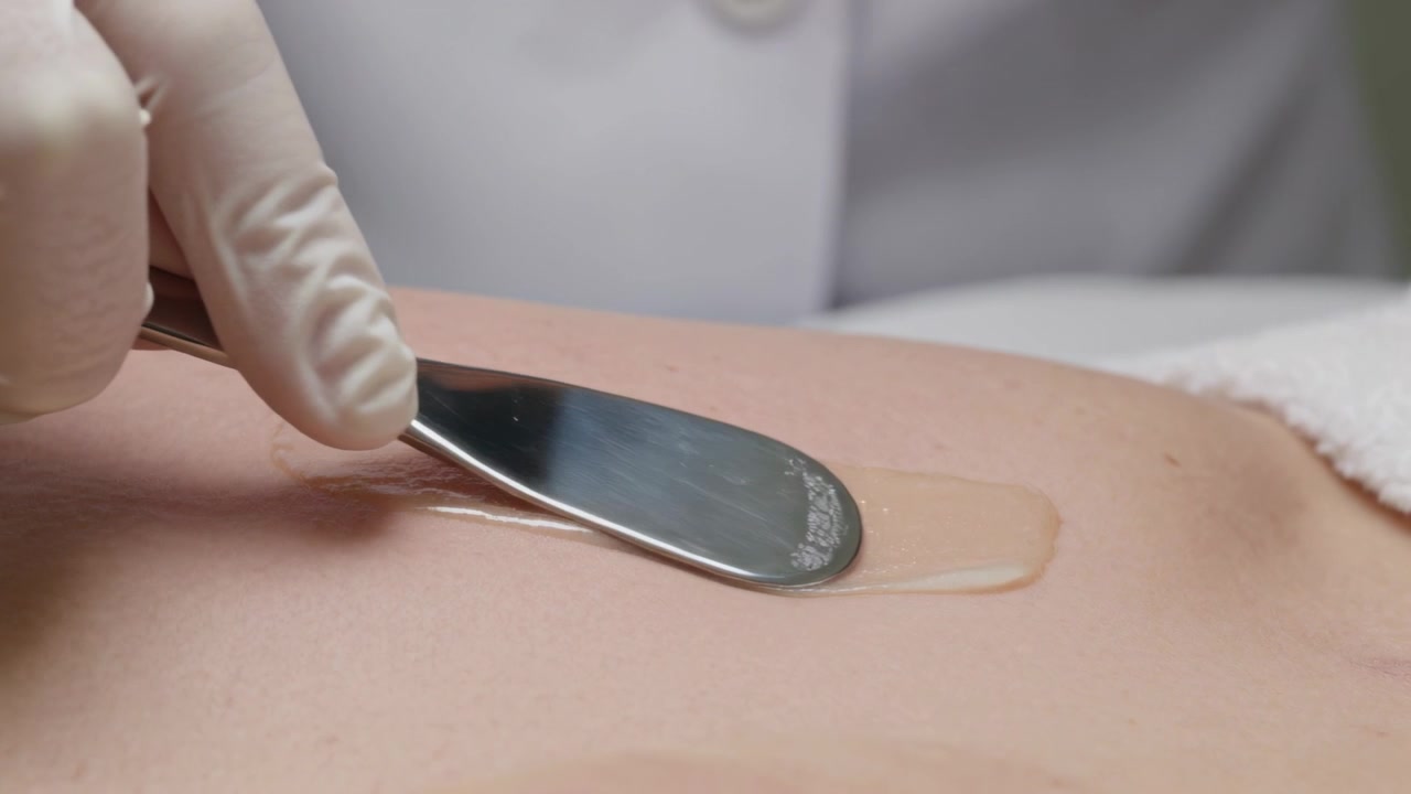 Abbassando la spatola, un tecnico guantato in camice bianco stende cera beige sull'addome inferiore del cliente per la depilazione.