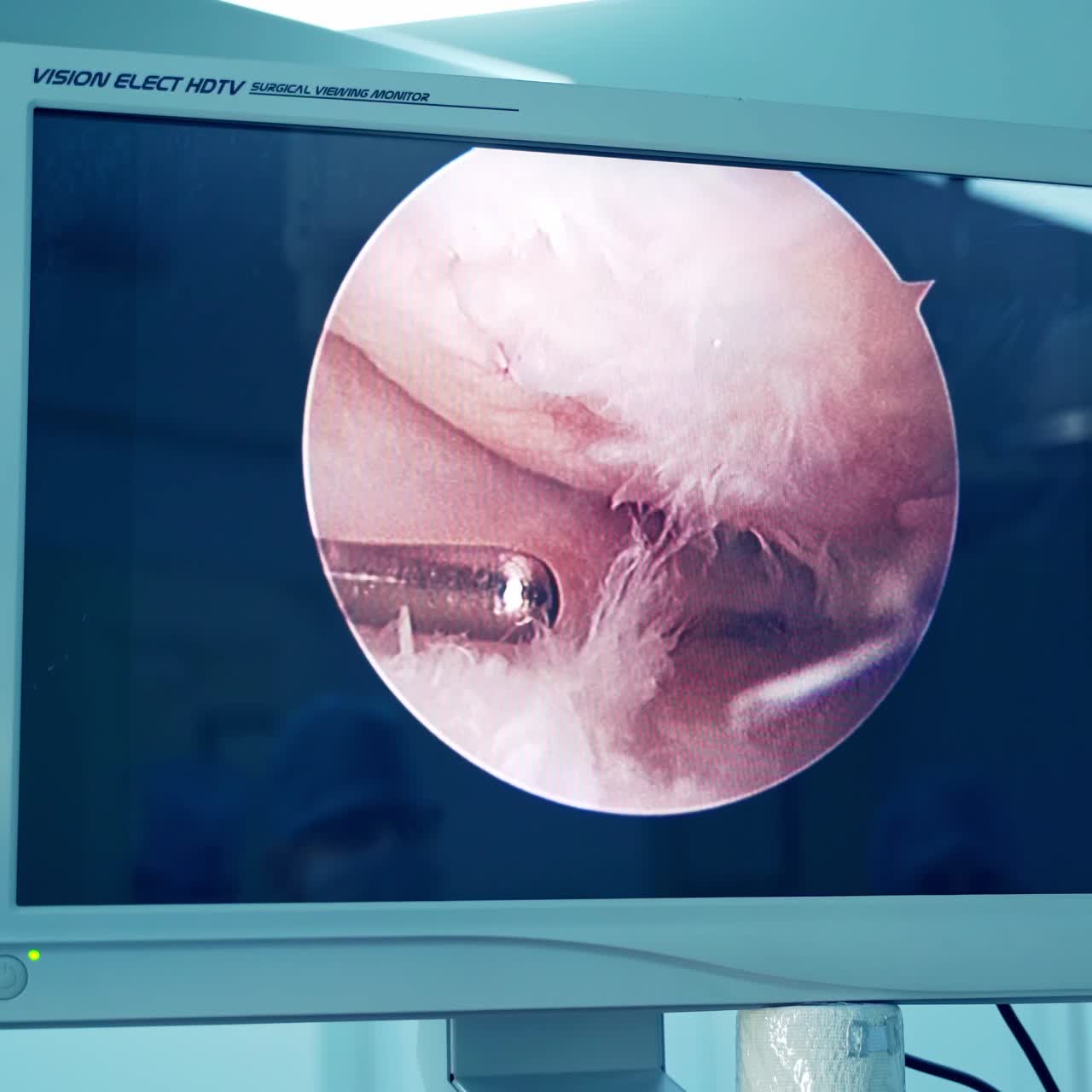 Medical Team Performing Surgical Operation. Professional surgeons performing operation for patient in modern hospital