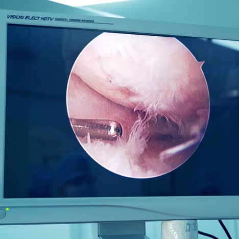 medical team performing surgical operation. professional surgeons performing operation for patient in modern hospital