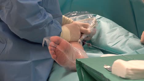 endovenous laser ablation is a commonly used and very effective minimally invasive therapy to manage leg varicosities