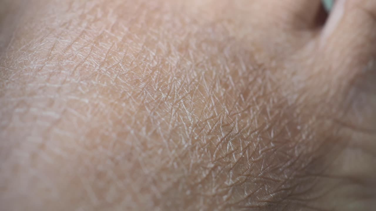 Close-up of Dry Skin Texture