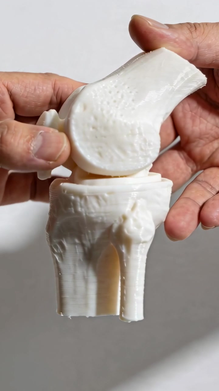 Vertical video: Placing kneecap, hands rotating knee model on table, revealing yellow spacer motion