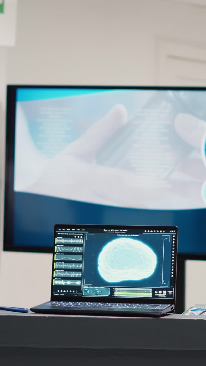 Video verticale: laptop con diagnosi del cervello sulla scrivania