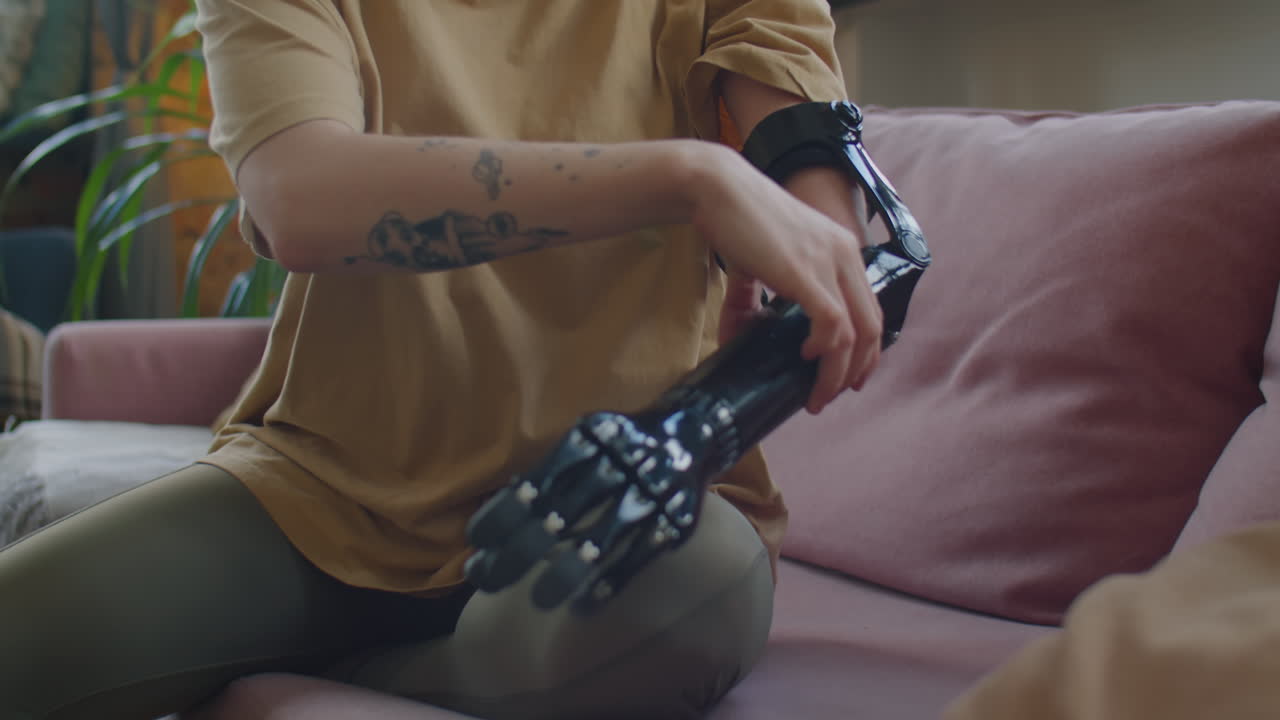 Girl Putting on Prosthetic Arm