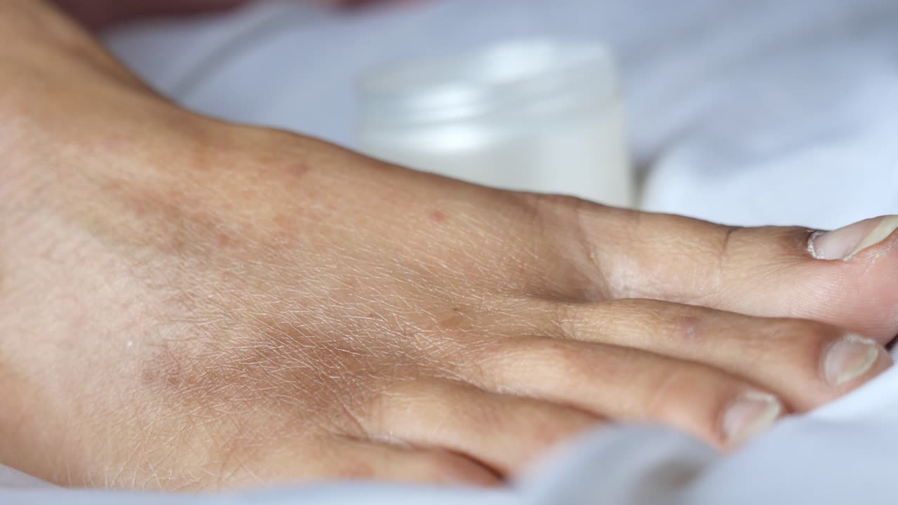 la aplicación de crema hidratante a los pies