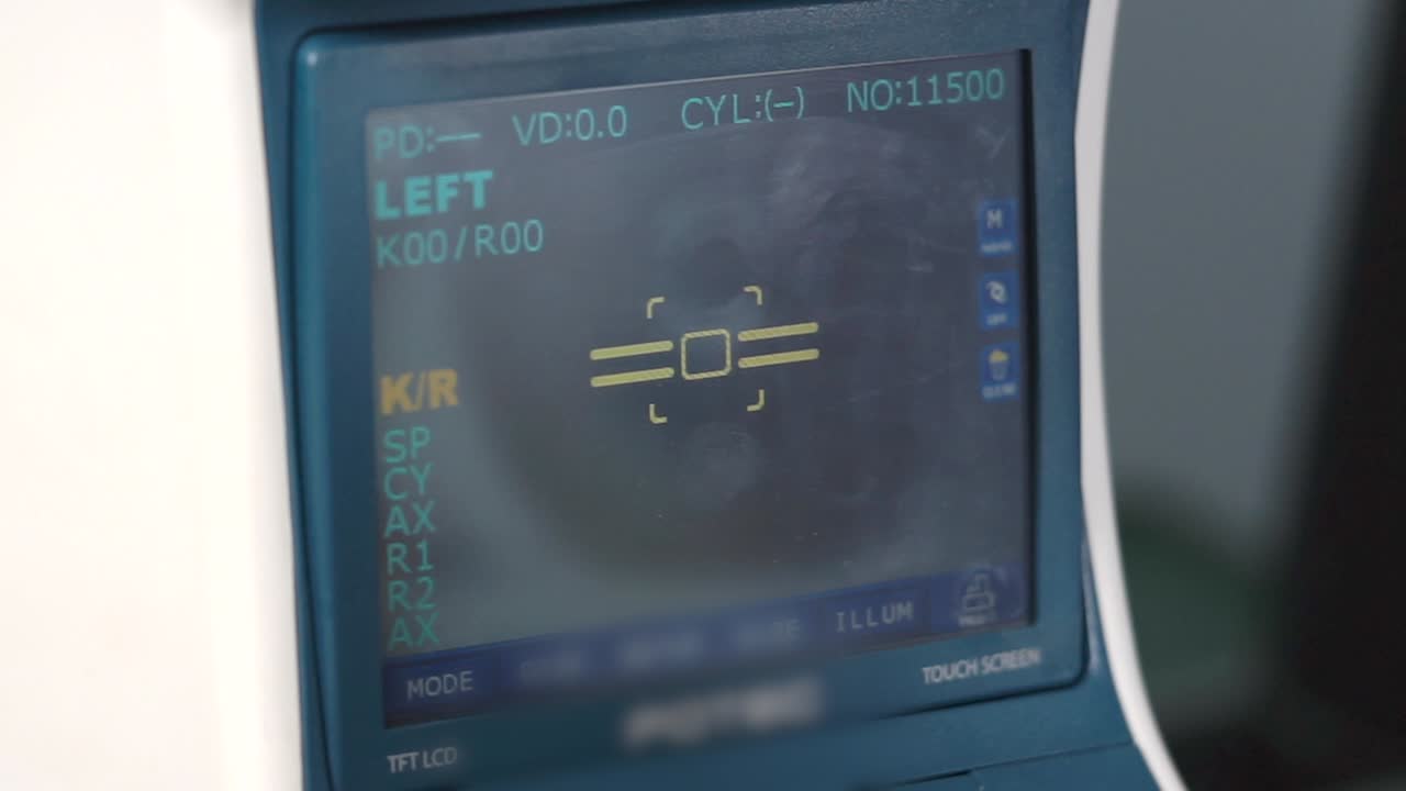 왼쪽 눈 데이터를 보여주는 눈 검사 디스플레이