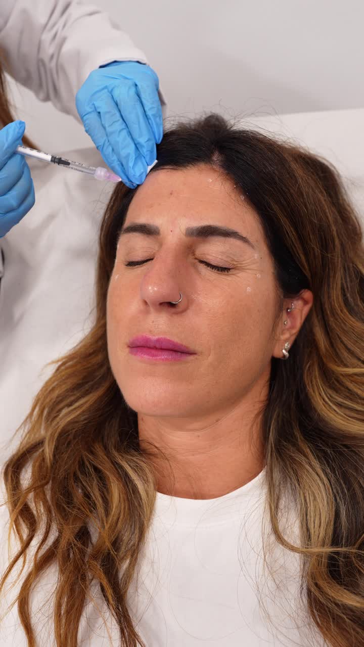 Procedura estetica: Iniezione di filler dermici