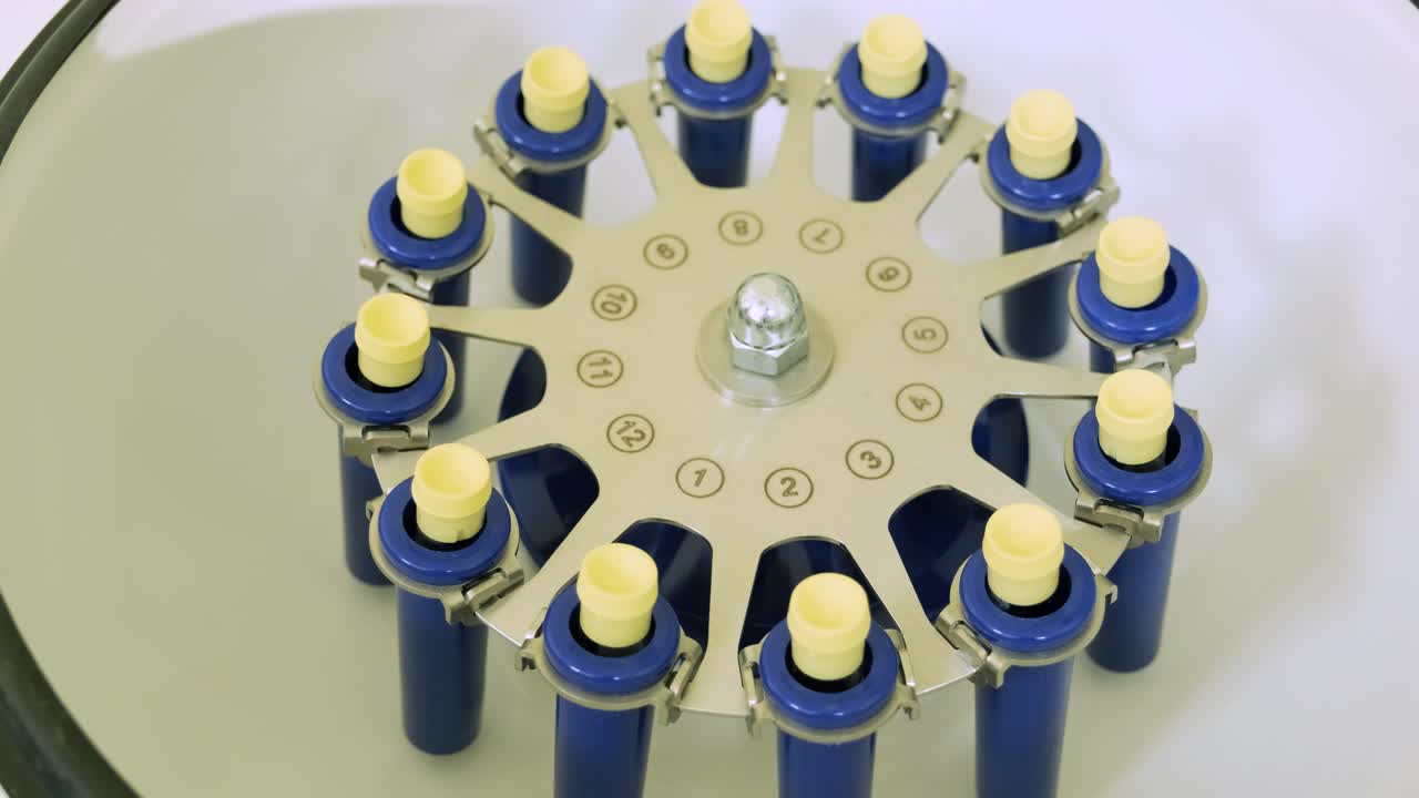 혈소판이 풍부한 플라즈마 준비: 손에 혈액을 가진 튜브, 원심분리기