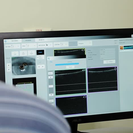 Ophthalmologist performing eye examination using advanced diagnostic equipment