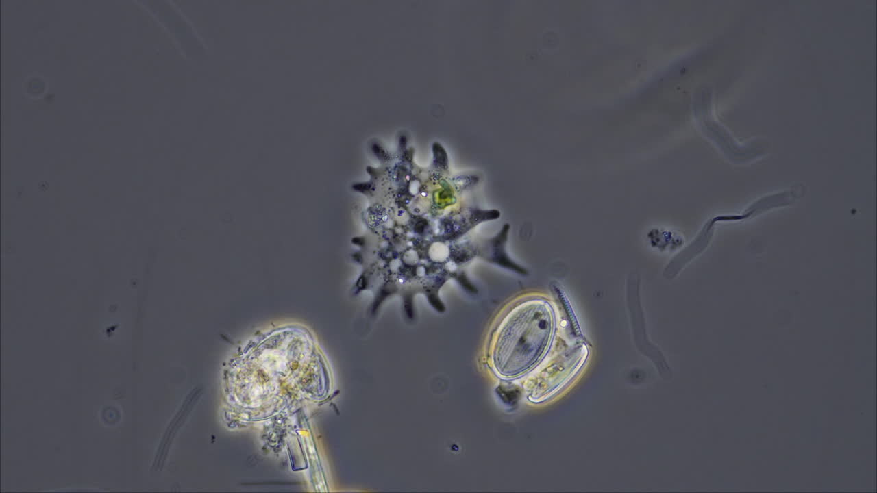 Microscopic view of various pond water microorganisms