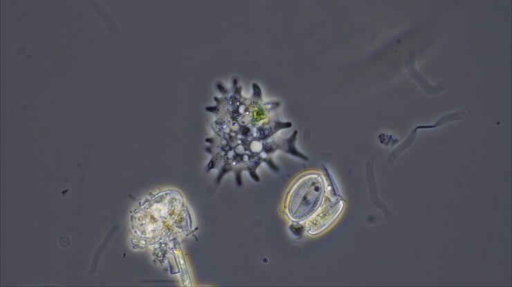 Microscopic view of various pond water microorganisms