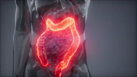 examen de radiología del colon humano