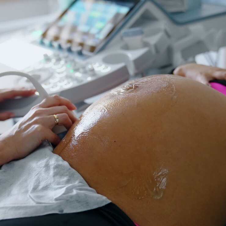 Pregnant woman is examined on ultrasonic equipment. Female doctor's hand moves the device by the big gelled belly of a future mom. Baby is kicking. Close up