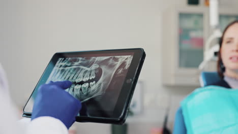 dentist reviewing dental x-ray with patient