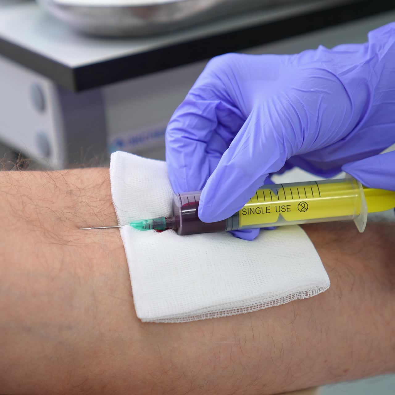 Taking blood for analysis in a hospital. Nurse in protective latex gloves carefully fills the big syringe with patient's blood. Close up