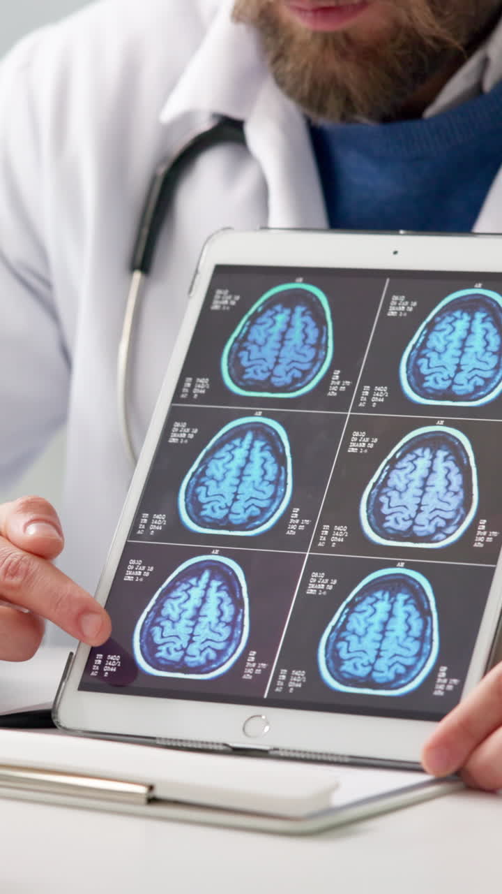 Il dottore rivede le scansioni cerebrali su tablet