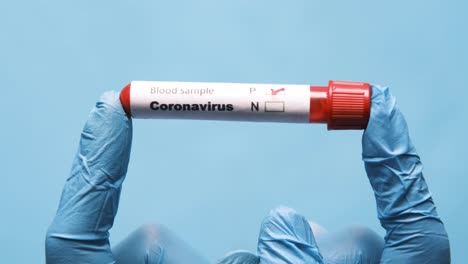 prueba de muestra de sangre de coronavirus