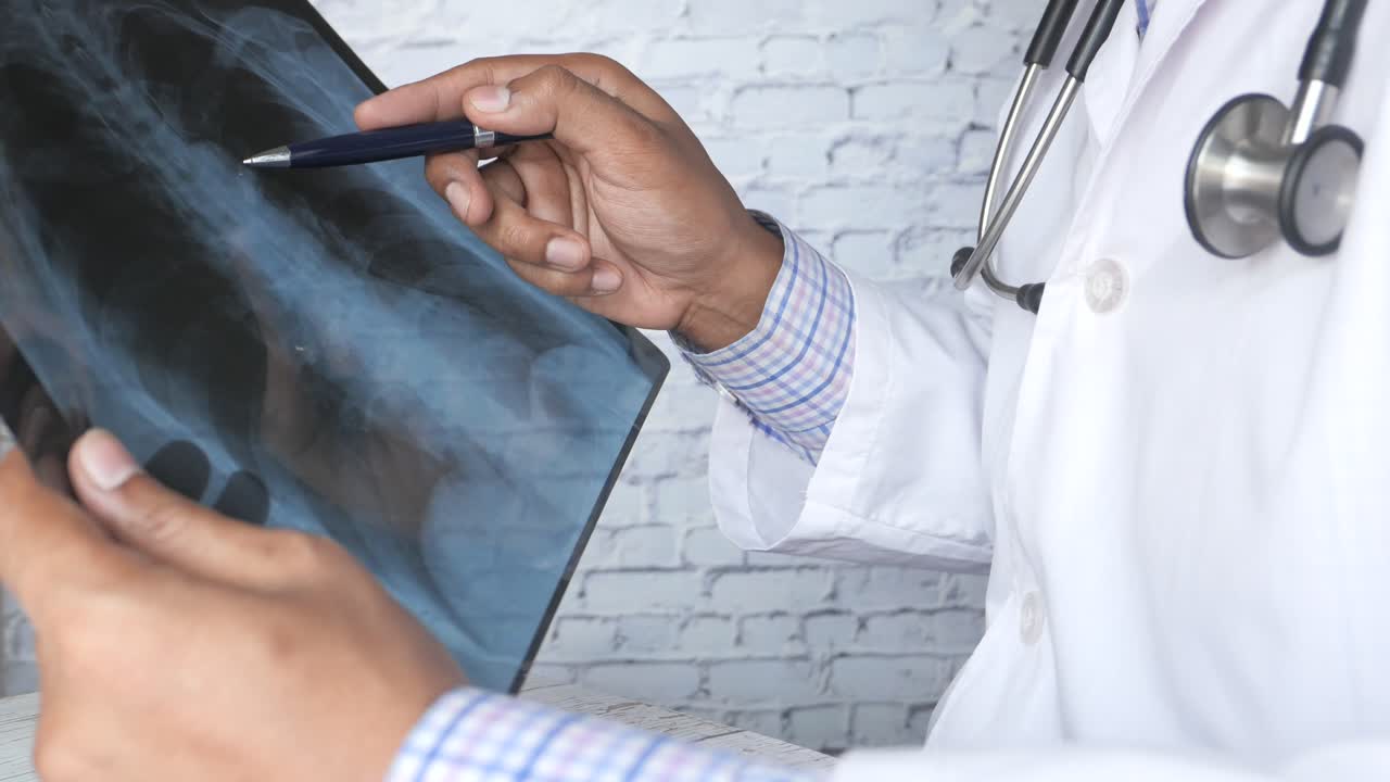 médico que examina las radiografías de tórax