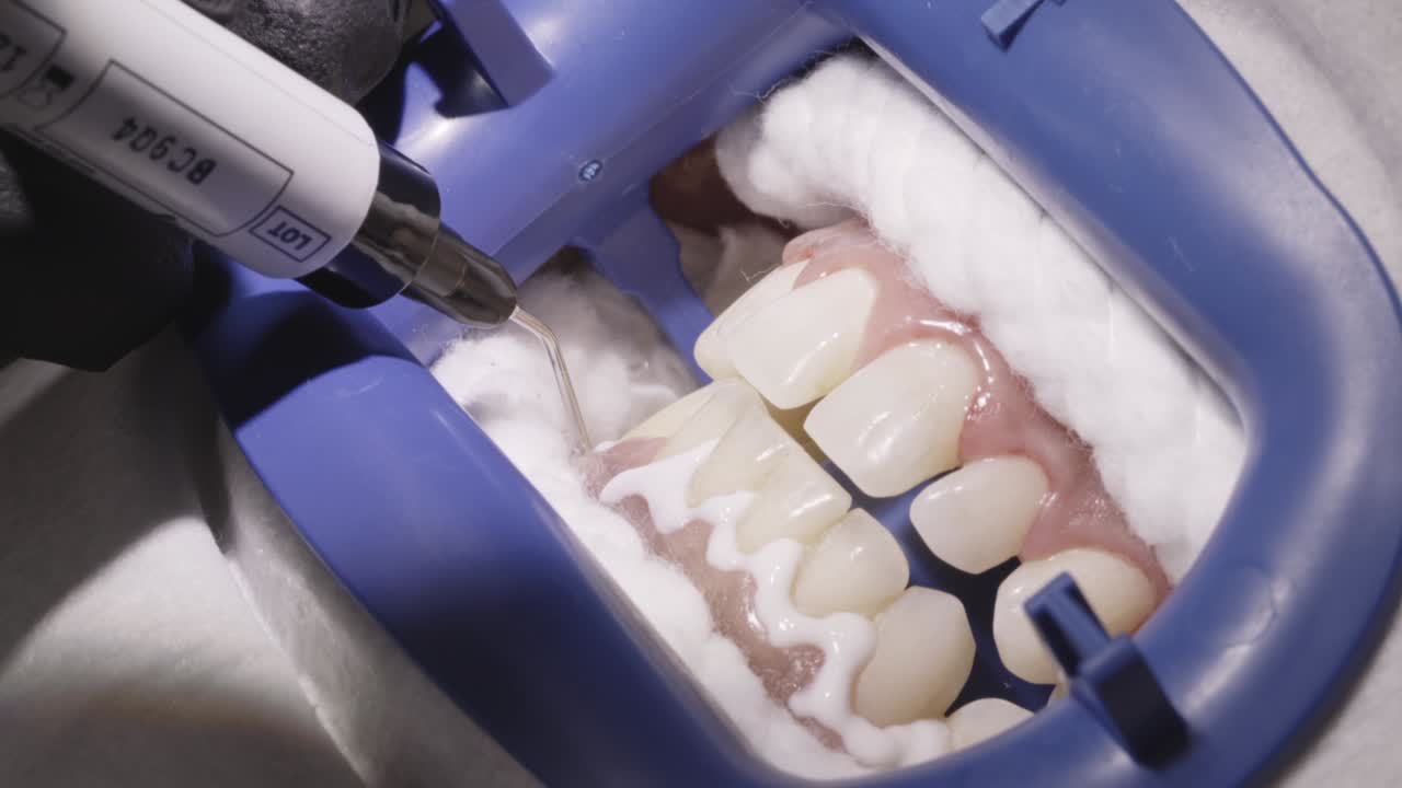 Gel being applied to teeth during dental procedure with specialized tools and cotton