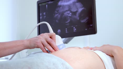 prenatal ultrasound procedure
