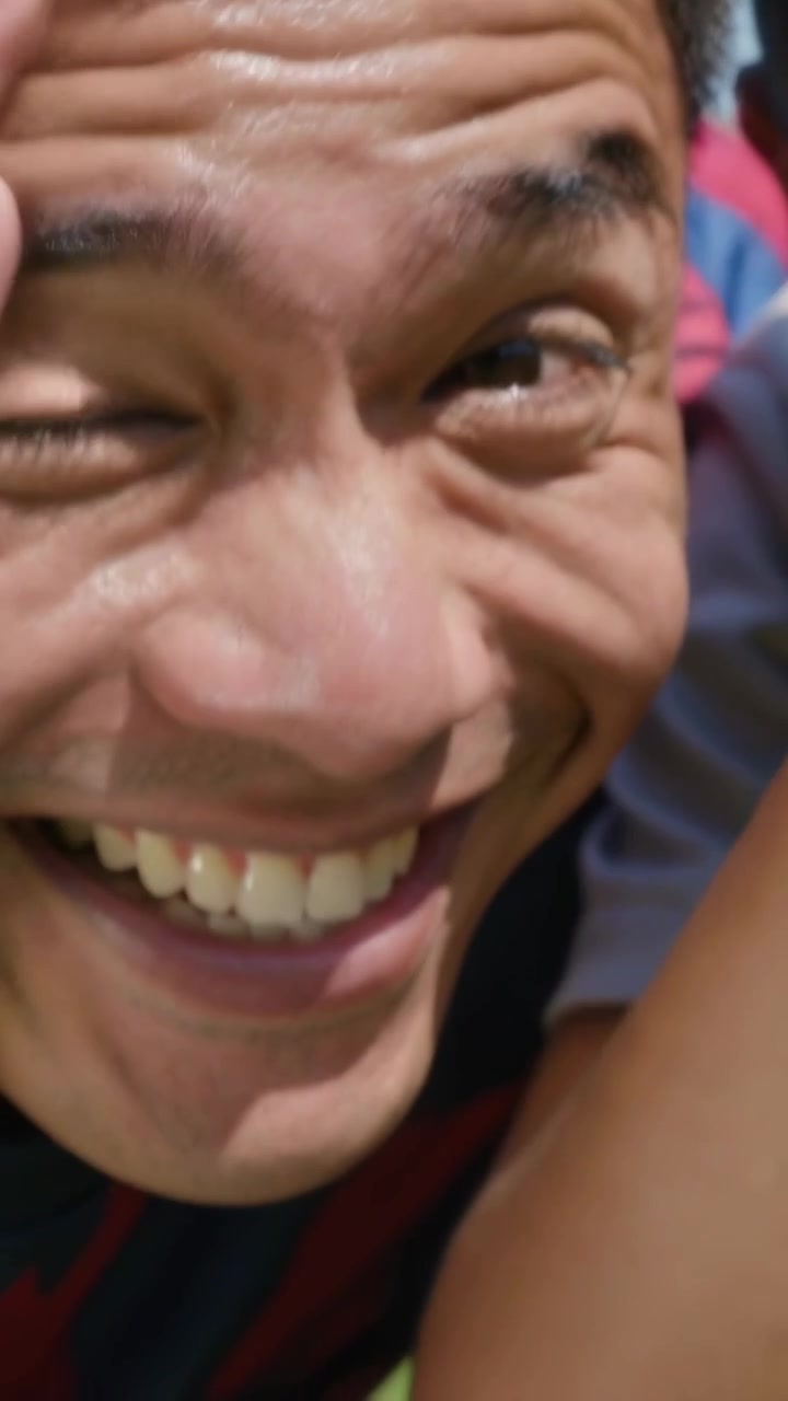 Video verticale: Uomo sorridente che reagisce alla telecamera, riparandosi l'occhio e tenendo una palla al parco, con divisa a strisce