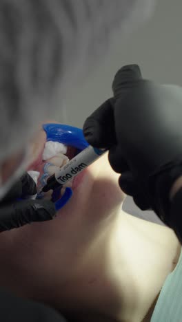 dentist applies gel for teeth whitening procedure, close-up, vertical