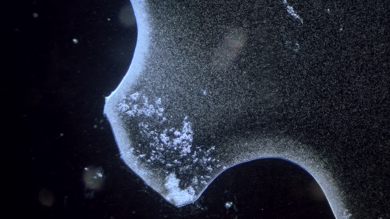 bajo aumento alta concentración de paramecio bajo el microscopio de campo oscuro