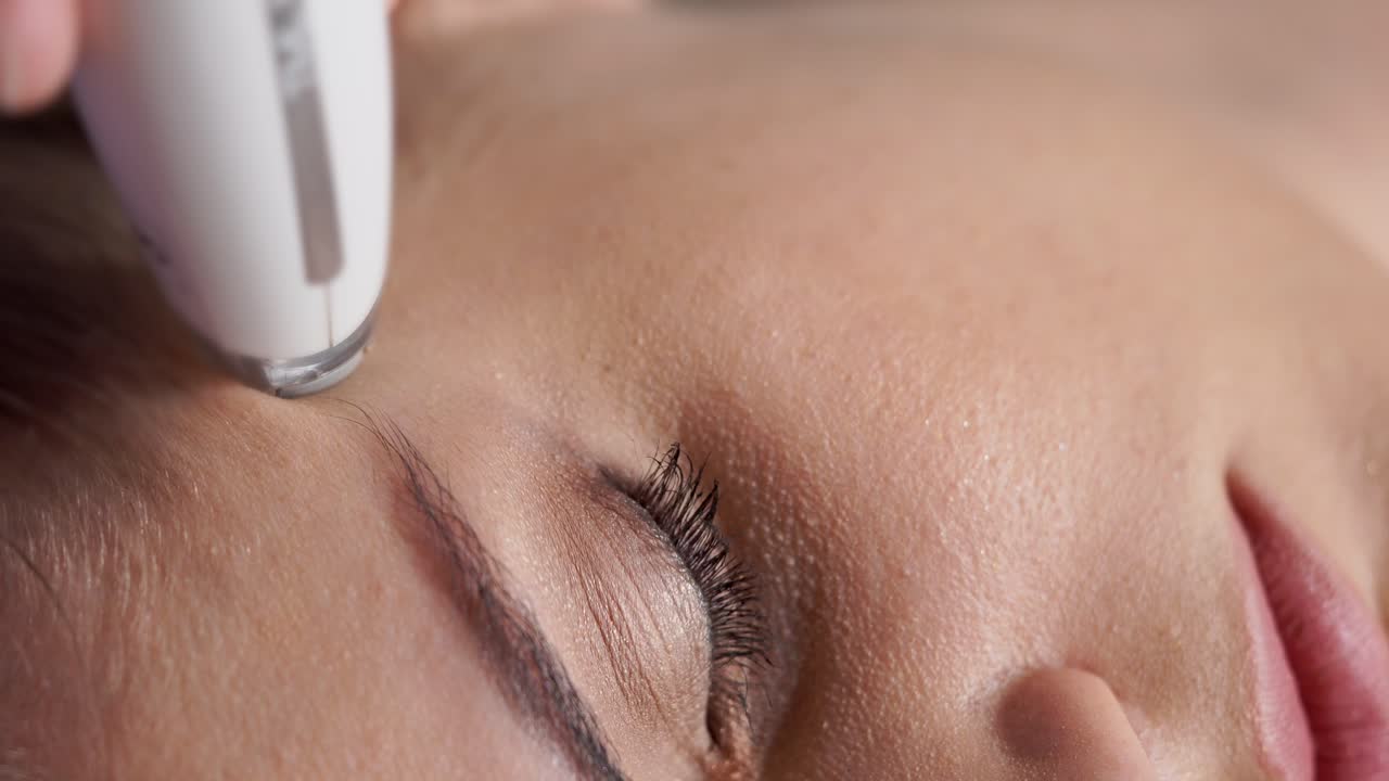 얼굴 치료를 받는 여성