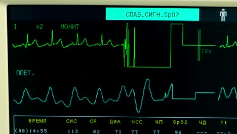 medical monitor display