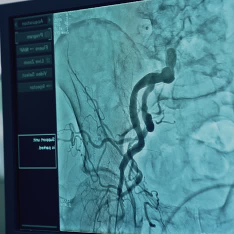 patient's bones displayed on hospital monitor. magnetic resonance. disease diagnostics. special medical equipment. computer shows x-ray of inner organs