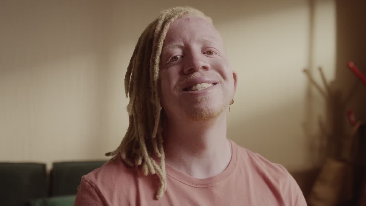 A close-up portrait of a smiling man with albinism and dreadlocks