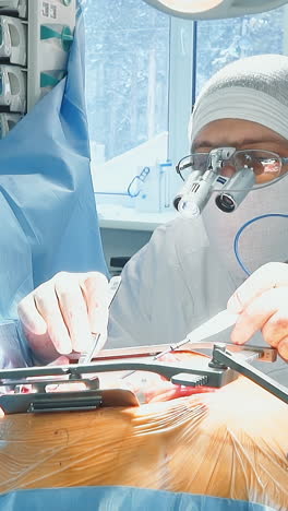 el médico trabaja con bisturí láser en la sala de cirugía. el cirujano con herramientas ópticas realiza cirugía de derivación de arterias en el hospital. tratamiento de enfermedades cardíacas