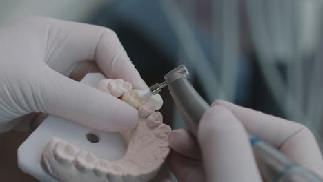 Close-up-on-dentist’s-hands-using-dental-polishing-brush