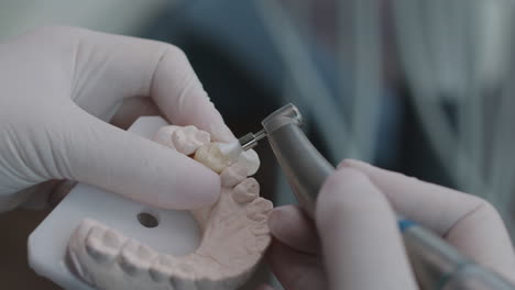 close up on dentist’s hands using dental polishing brush