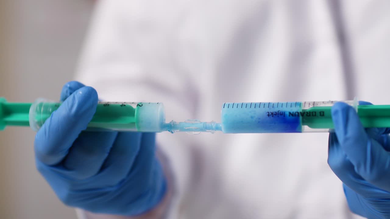 dos jeringas empujan un líquido hacia atrás y hacia adelante con un líquido de crema dentro