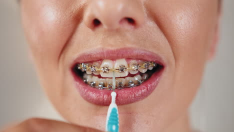 mujer limpiando los dientes con aparatos ortopédicos usando un cepillo interdental
