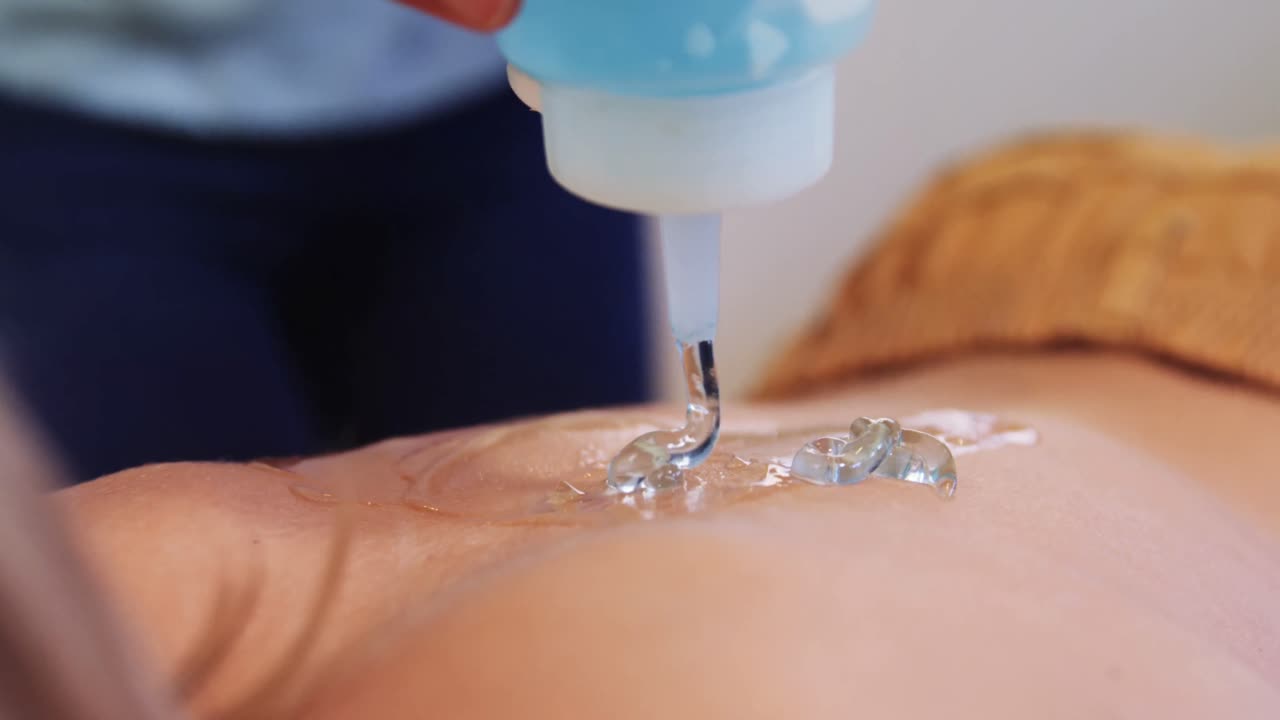 fisioterapeuta poniendo gel en la espalda del paciente 4k