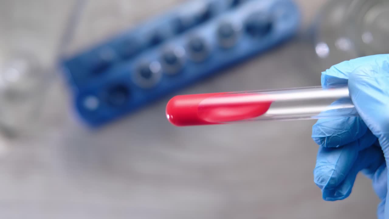 Blood Sample in Test Tube